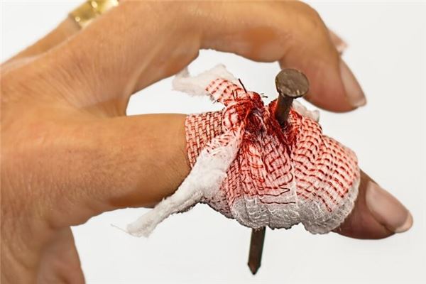 梦见流血预示着什么