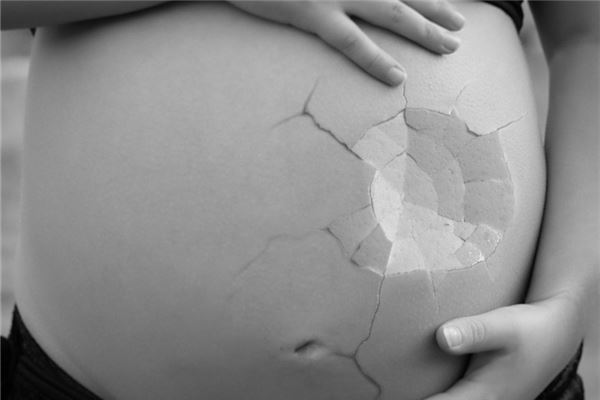 梦见流产出血是什么意思