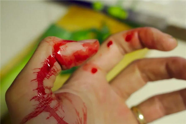 梦见流血是什么意思