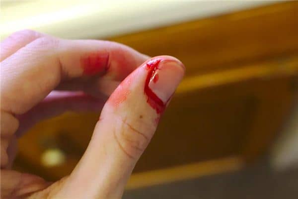 梦见手指破了流血是什么意思