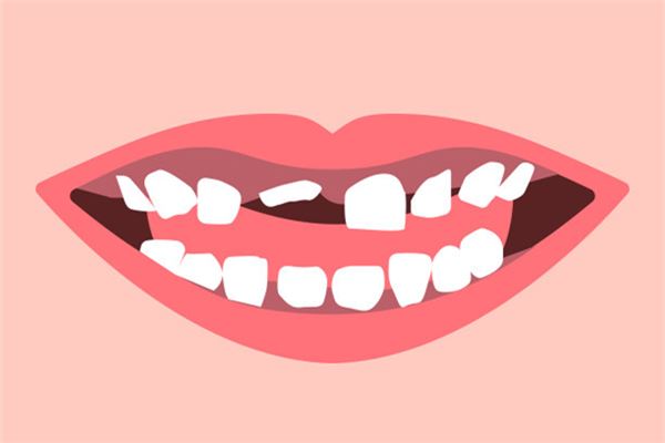 梦见牙齿掉了一颗是什么意思