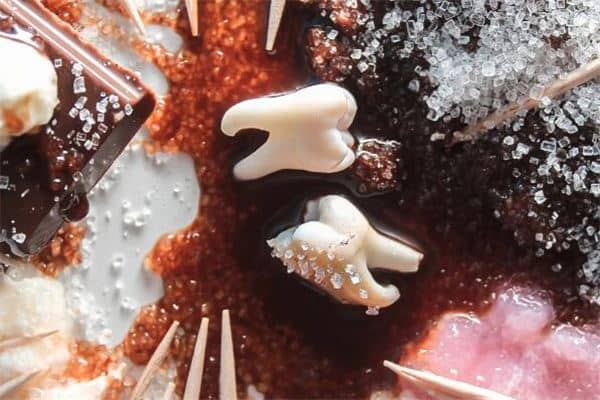 梦见牙齿松动是什么意思