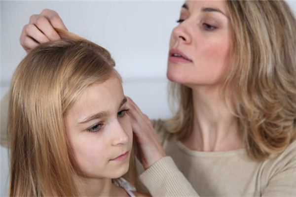 梦见头上长虱子是什么意思