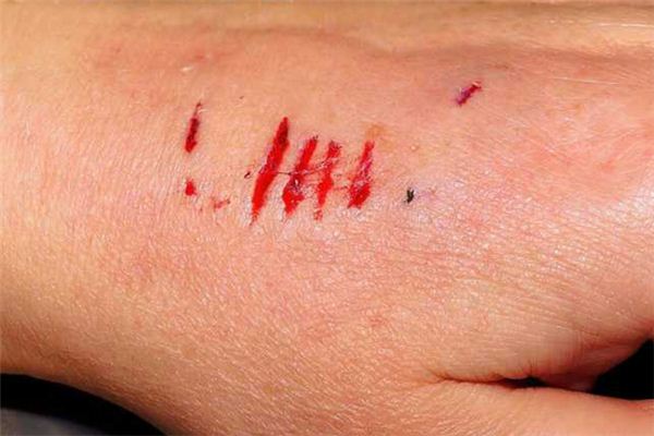 梦见被狗咬:人被犬咬,家庭生隙