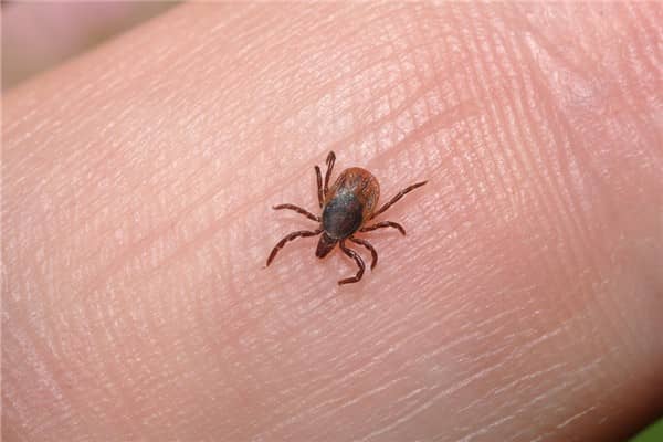 梦见头虱是什么意思