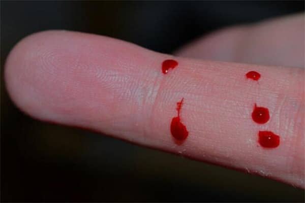 梦到被蛇咬流血是什么意思