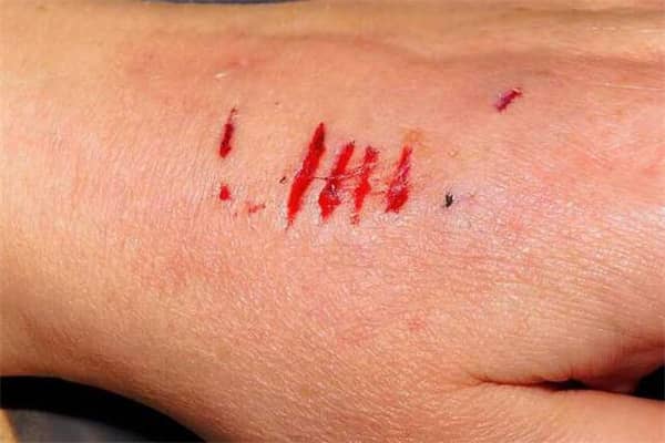 梦到了狗咬流血是什么意思