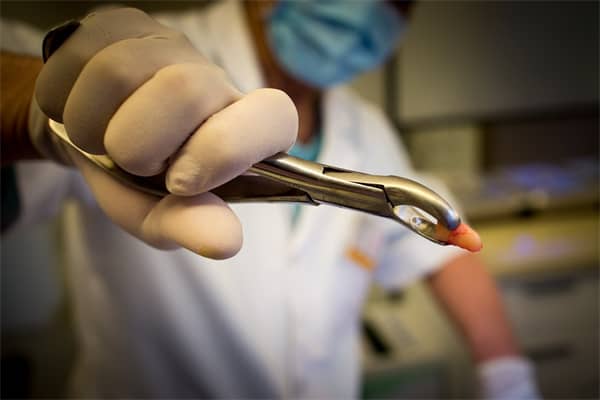 梦见牙齿掉了是什么意思