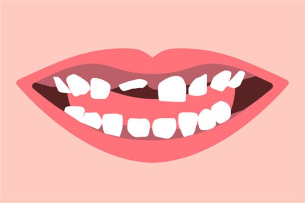 梦见牙掉了是什么意思