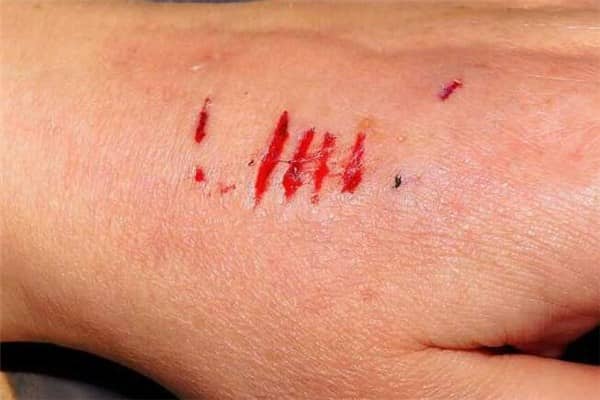 梦到了背狗咬是什么意思