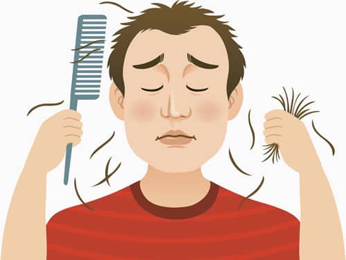 脱发